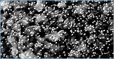 Insulin-Biomedical Aerosols.