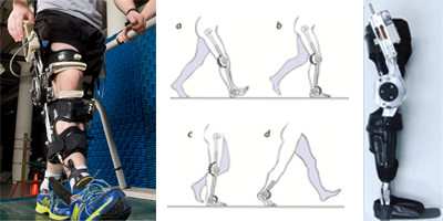 Active Orthoses