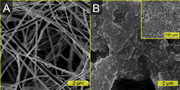Omniphobic membrane structure