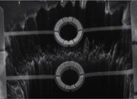 Detector